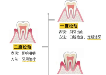 老年人牙齒松動了要怎么辦？