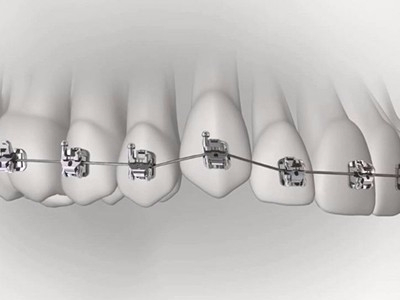 承德市哪家口腔醫(yī)院口腔正畸做得好？惟德口腔醫(yī)院來告訴您