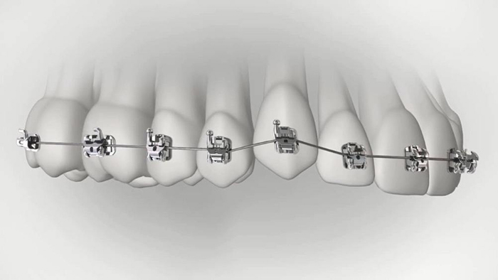 承德市哪家口腔醫(yī)院口腔正畸做得好？惟德口腔醫(yī)院來告訴您